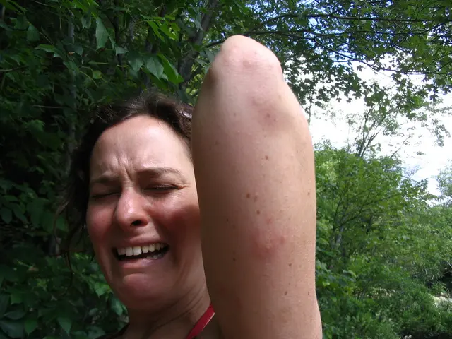 Signs and indicators of burnout: a condition marked by emotional, physical, and mental exhaustion,...